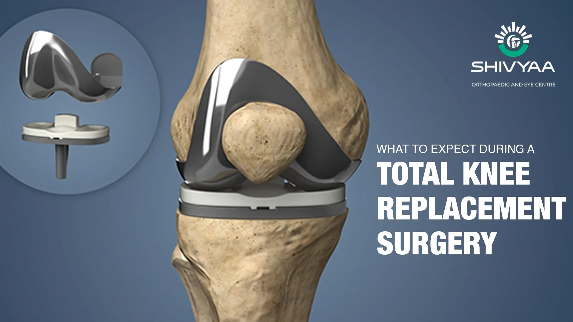 benefits and risks of knee replacement surgery