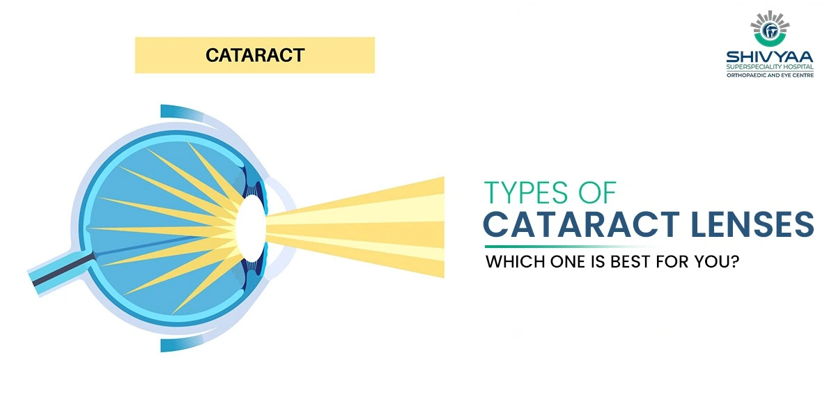 different types of cataract lenses for eyes
