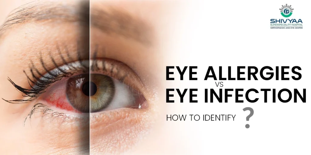 comparison between eye allergy vs eye infection