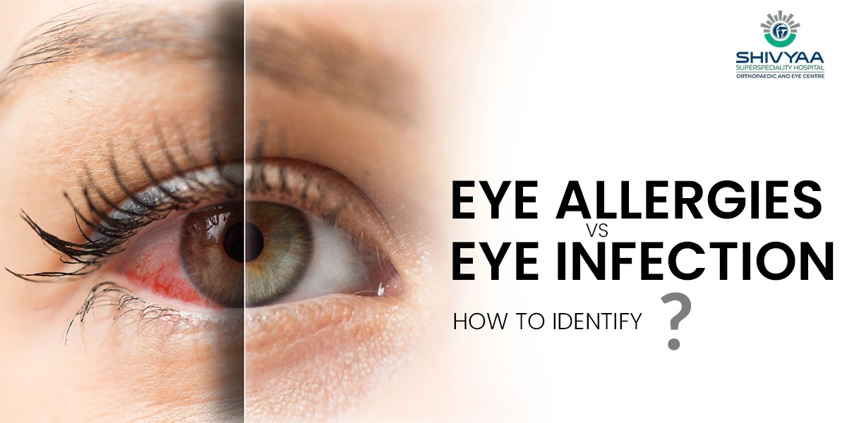 comparison between eye allergy vs eye infection