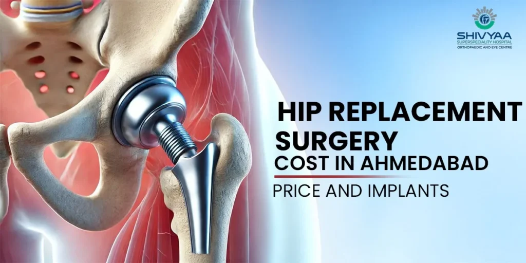 How Much Does a Hip Replacement Implant Cost