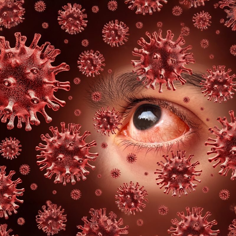 01 Allergic Conjunctivitis