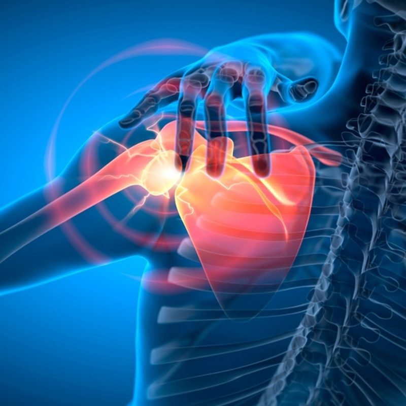 Symptoms-of-Shoulder-Problems