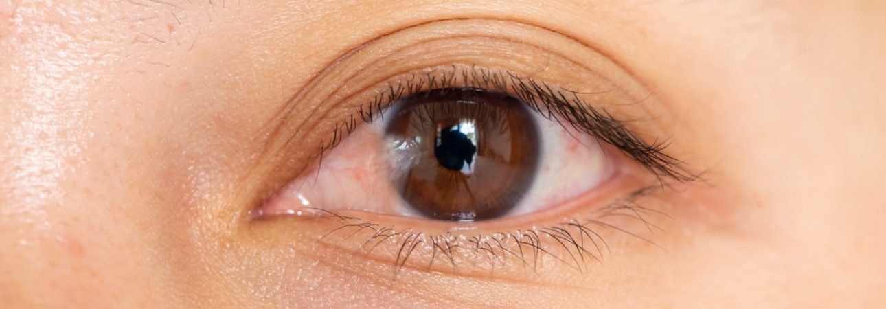 Close,Up,Of,The,Pterygium,During,Eye,Examination,For,Wallpaper